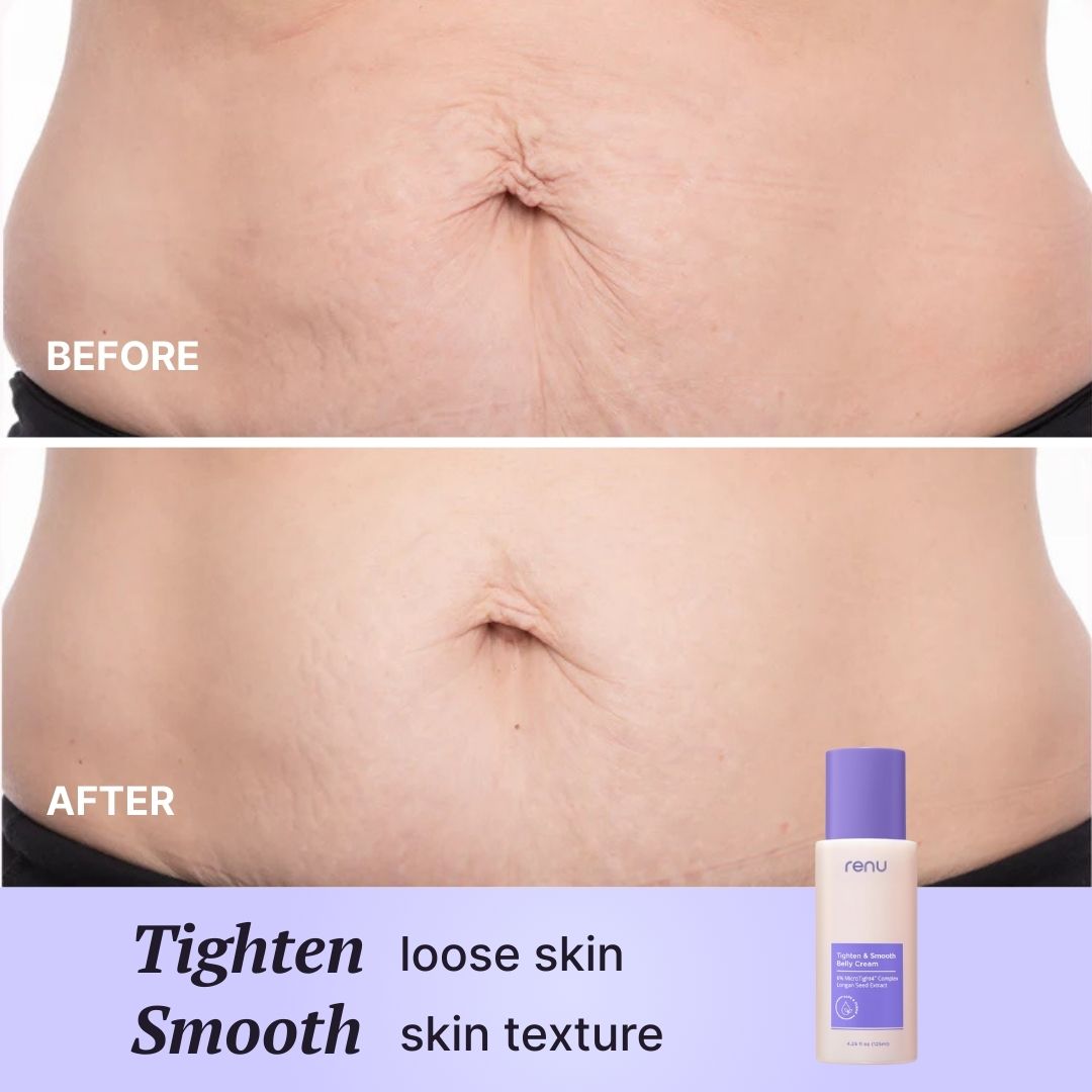 Tighten & Smooth Belly Cream