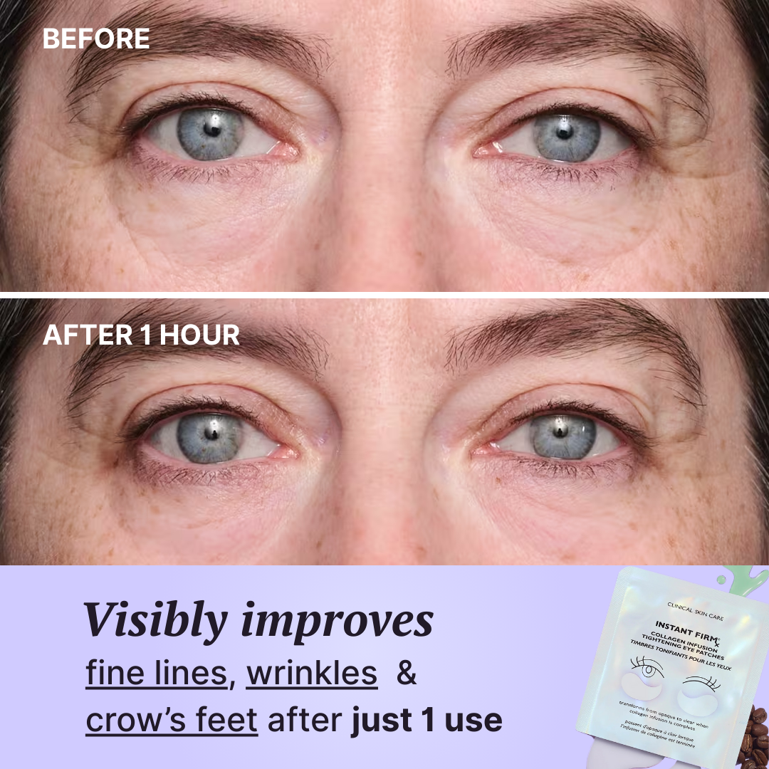 Instant Tightening Collagen Infusion Eye Patches