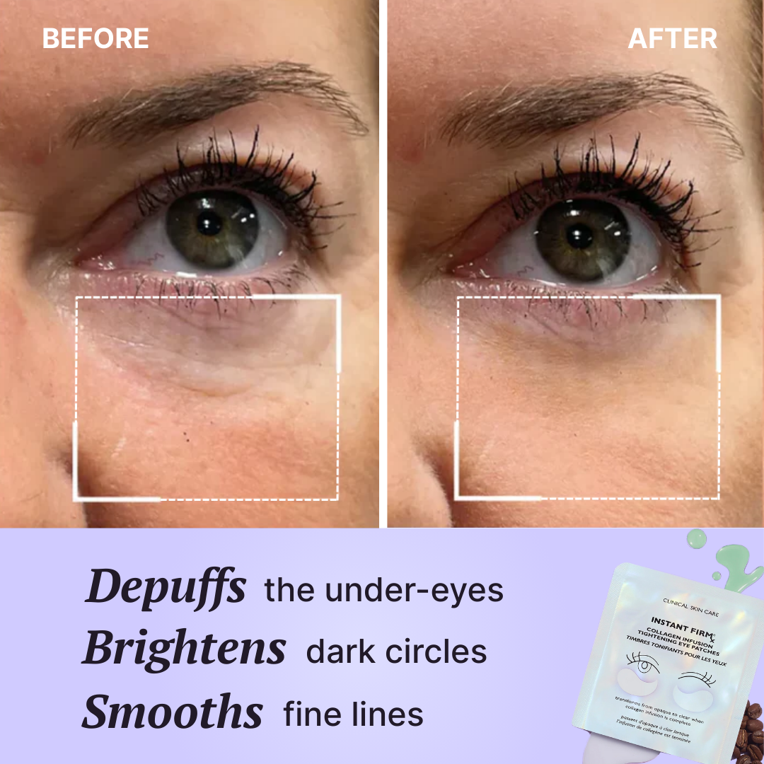 Instant Tightening Collagen Infusion Eye Patches