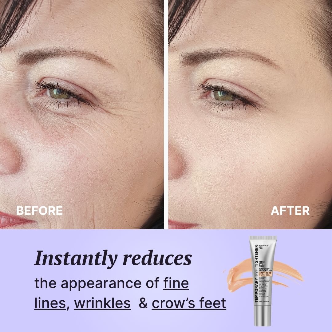 Renu Instant Eye Tightener