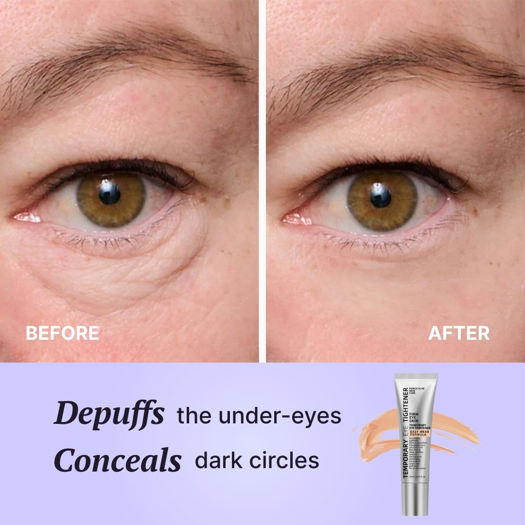 Renu Instant Eye Tightener