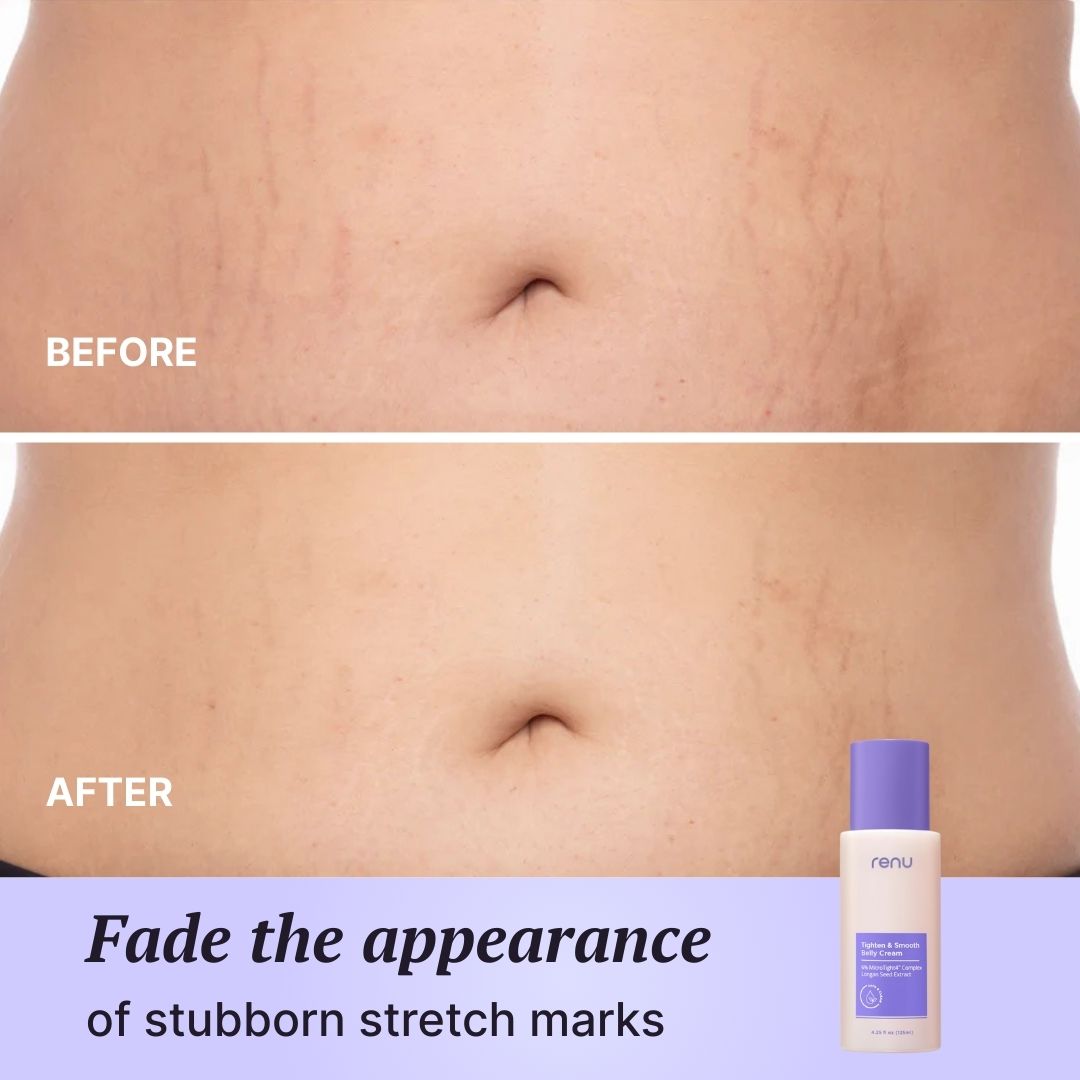 Tighten & Smooth Belly Cream
