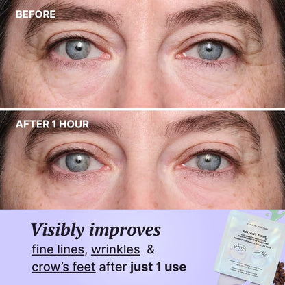 FirmX Collagen Infusion Eye Patches