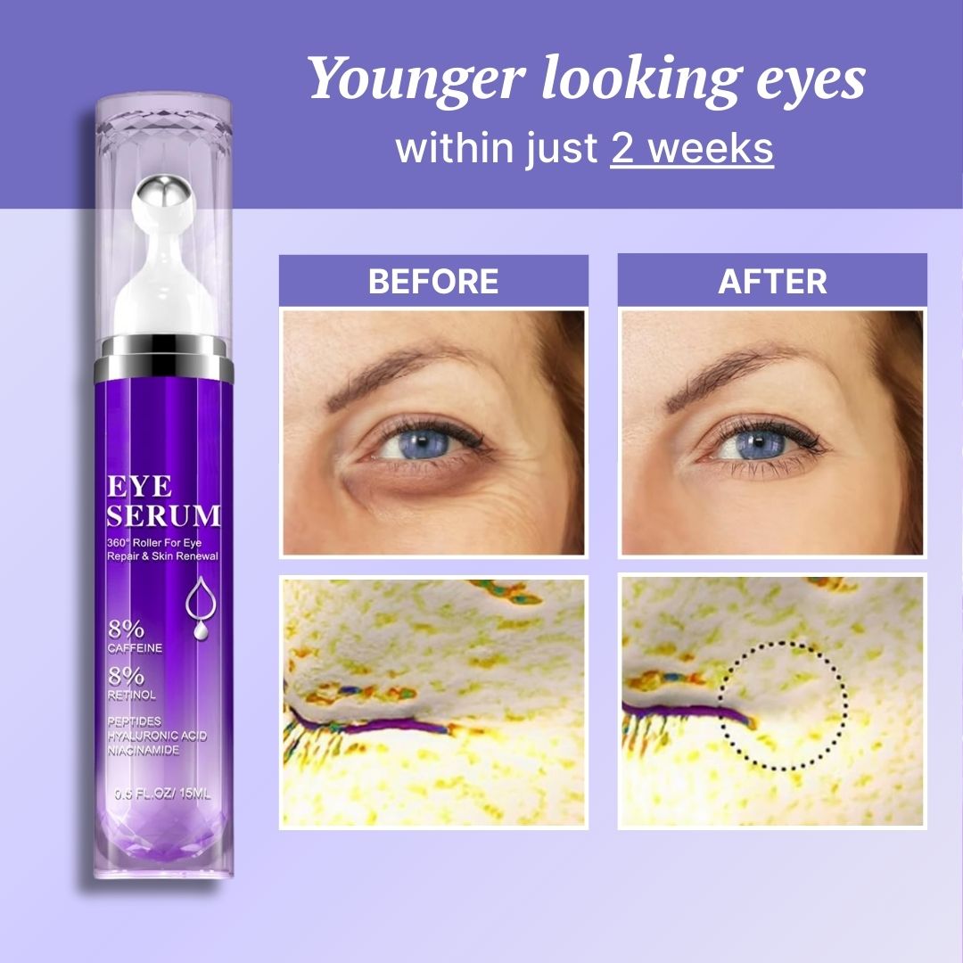 Overnight Eye Renew Serum