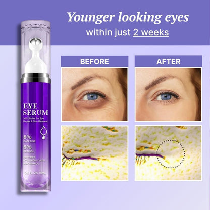 Overnight Eye Renew Serum